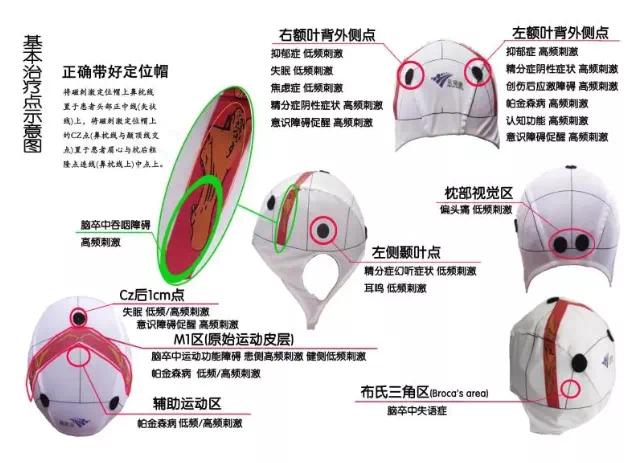 运动皮层m1区体表定位图片