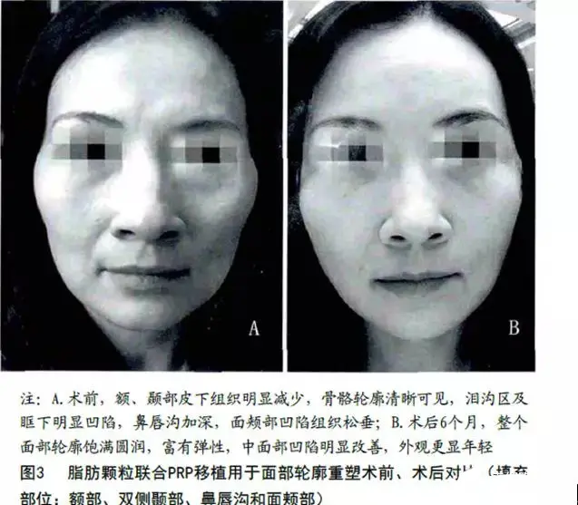 生产加工护肤品