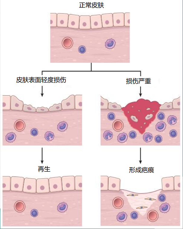 修复面膜加工