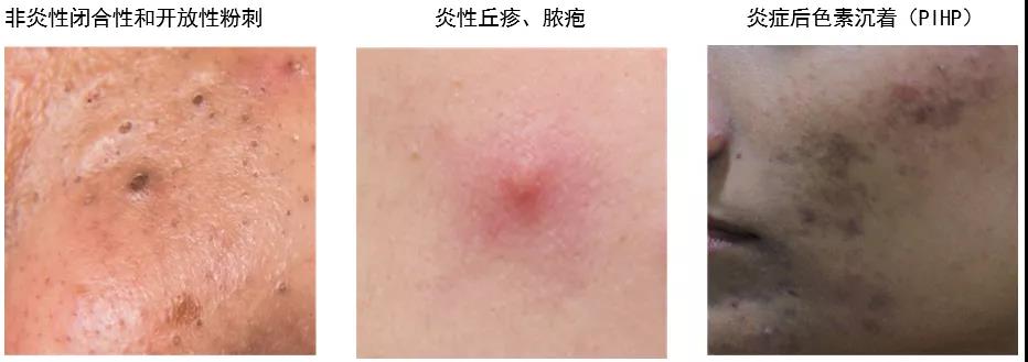 去痘印护肤品生产商