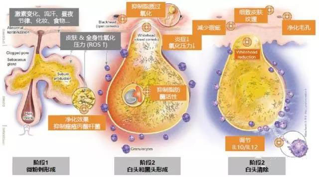 祛痘面膜加工