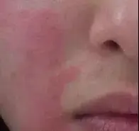 oem面膜加工厂家