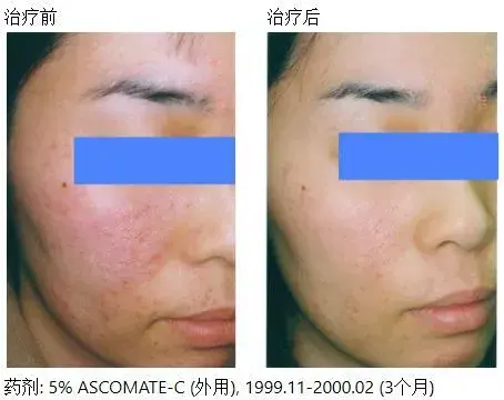 代加工品牌化妆品