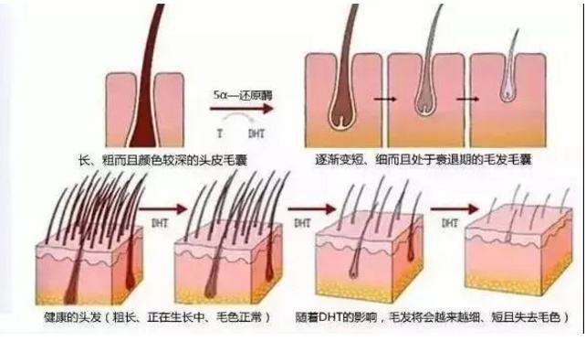 真正防脱生发产品