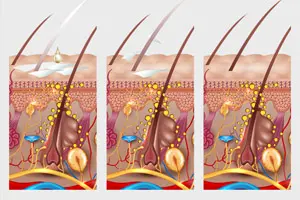 正宗的生发产品