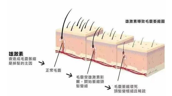 生发液oem批发商