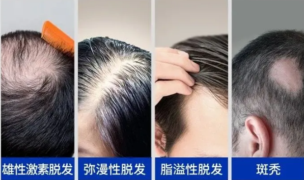头发快速生长液