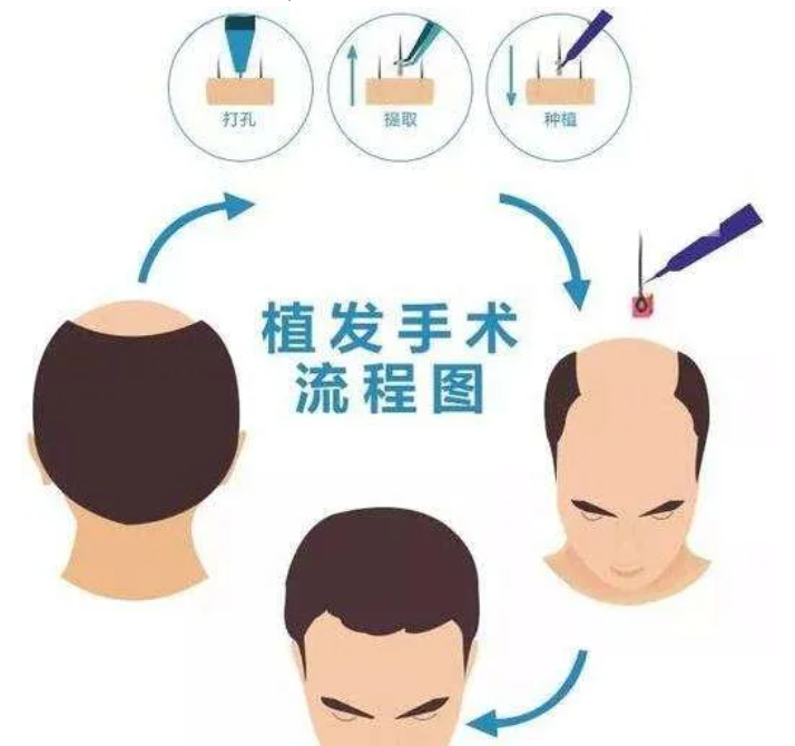 产后生发产品