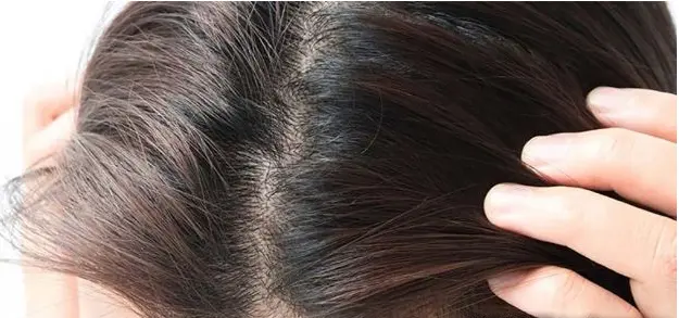 轻定制防脱育发液
