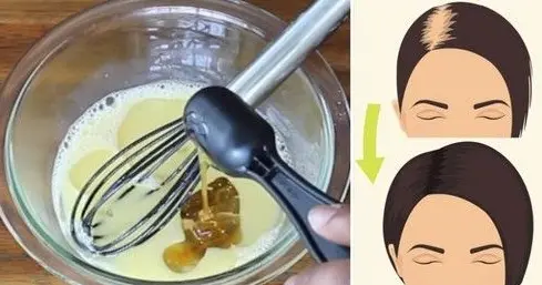 头发增长液oem厂家