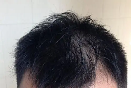 生发化妆品代加工厂