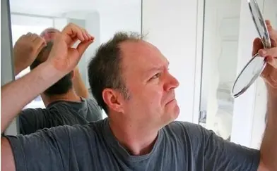 什么产品可防脱生发