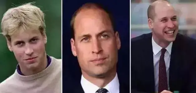 即去屑又生发的产品