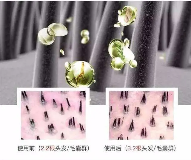 比较好的生发产品