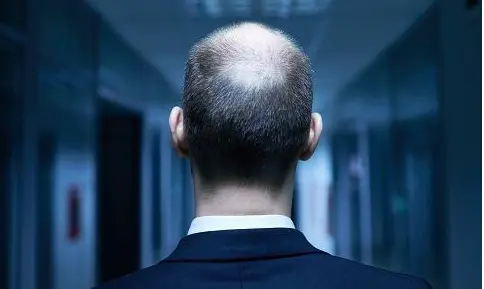 防脱生发产品加盟