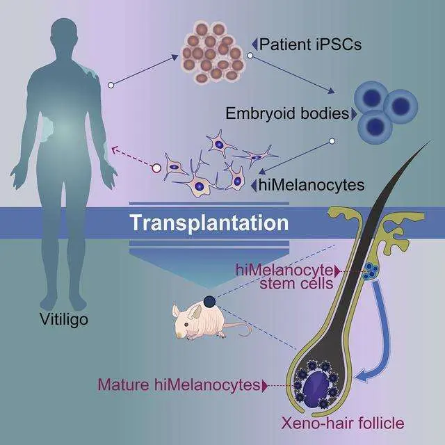 防脱生发产品排行榜