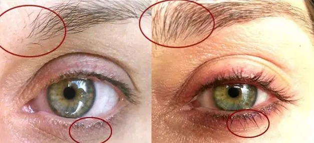 最靠谱的生发产品