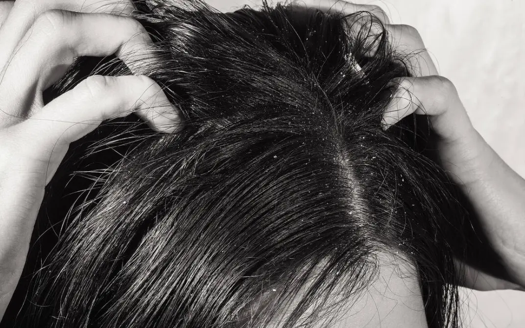 汉方生发养发产品