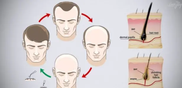 防脱发育发产品