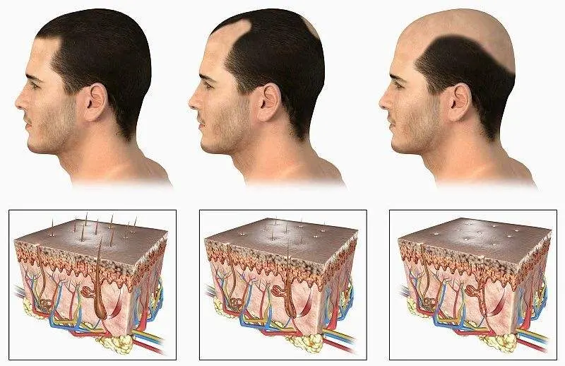 育发效果最好的产品