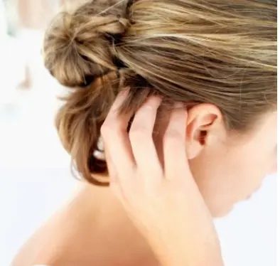 生发水育发液厂家