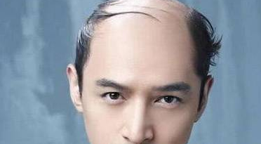 中药防脱生发产品