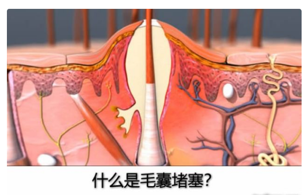 化妆品冻干粉厂家