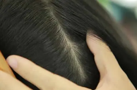 正宗防脱生发产品生产