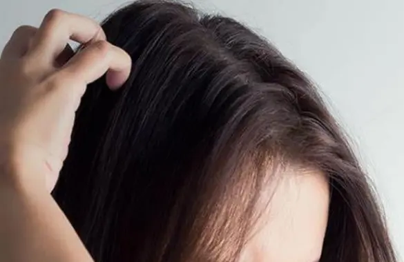 最好的生发产品厂家