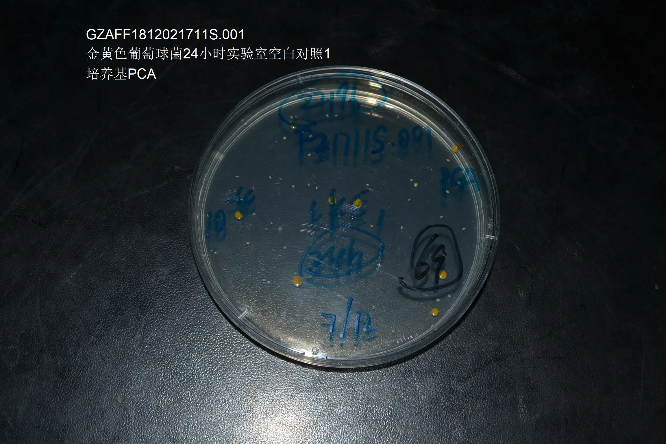金黄色葡萄球菌24时实验室空白对照S1 