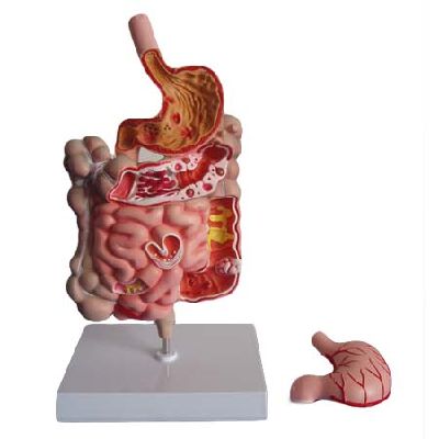  EP-1093 Intestine with stomach modle