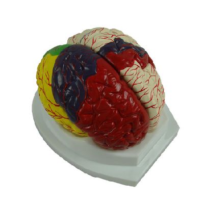 EP-1490 Brain Model