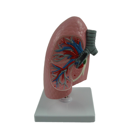EP-1482 Lung Model