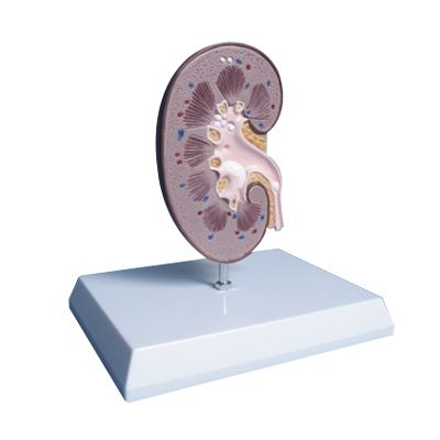 EP-676 Kidney and renal calculus model