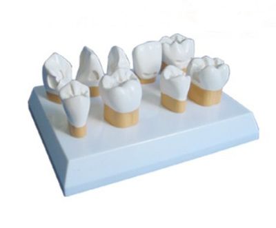EP-669 Teeth Model