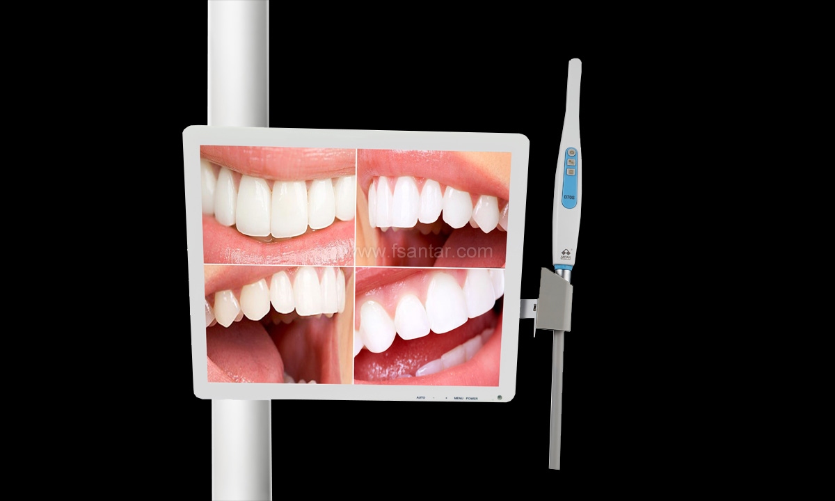 Intraoral Camera with 17inch Multimedia LED Monitor